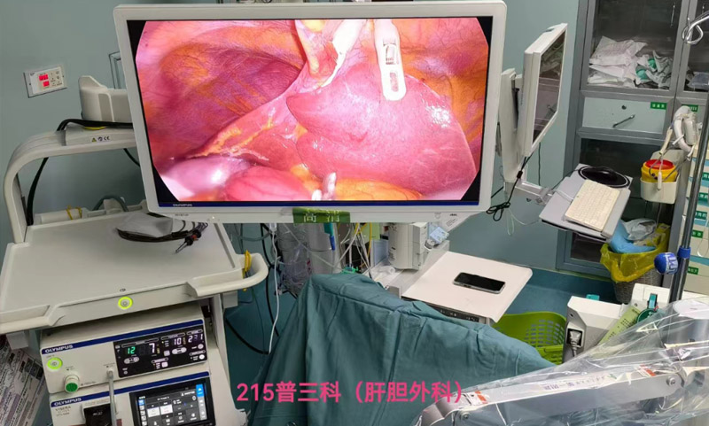 陕西省核工业二一五医院应用磁牵引术野暴露系统完成咸阳区域首例胰十二指肠切除手术